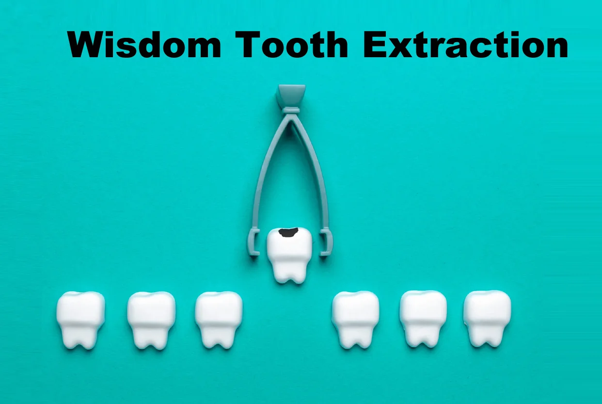 Painless Wisdom Tooth Removal (3rd Molar)